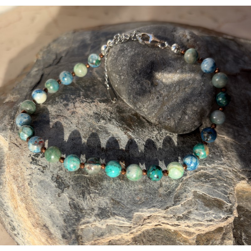 Shattuckit Ankle Chains